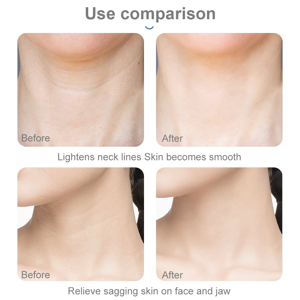 AmazeFan Facial Neck Massager 3 Colors Led Photon Therapy lifting Wrinkle Removal Beauty Device Reduce Double Chin Skin CareTool